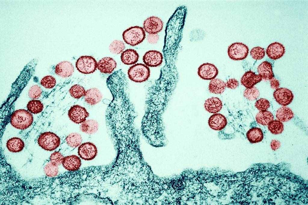 什么是汉坦病毒，汉坦病毒所致常见疾病有哪些？