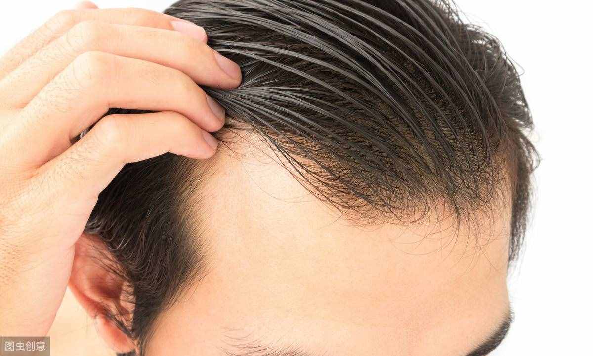 头皮疼、头皮瘙痒都是什么原因导致的？哪些因素可能导致头皮发痒