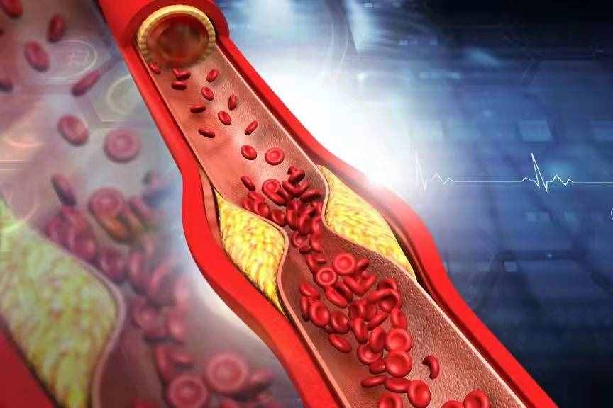 胆固醇升高，不要怕，哈佛大学：常吃这5种食物，胆固醇悄悄降