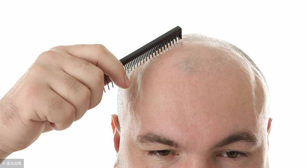 人正常每天掉几根头发？医生提醒：没超过这个数，都不算脱发！
