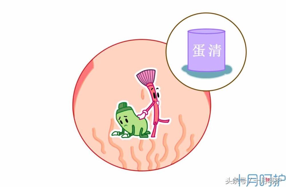 一不小心长了妊娠纹怎么办？这10种方法可以有效缓解和减轻