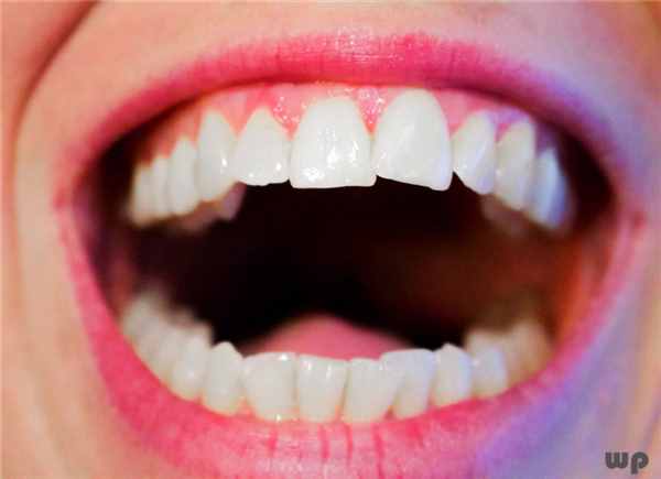 洗牙对牙齿有伤害吗？医生给出合理解答，早知早受益