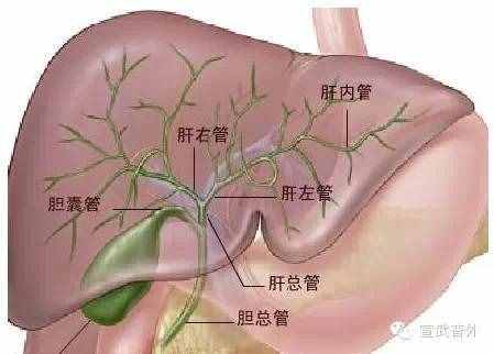 黄疸是怎么回事？