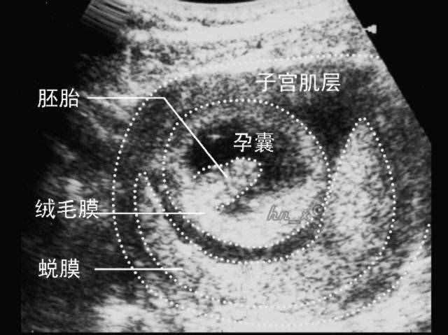 孕早期胎儿发育过程，怎么做能促进孕囊发育？刚怀孕的孕妈了解