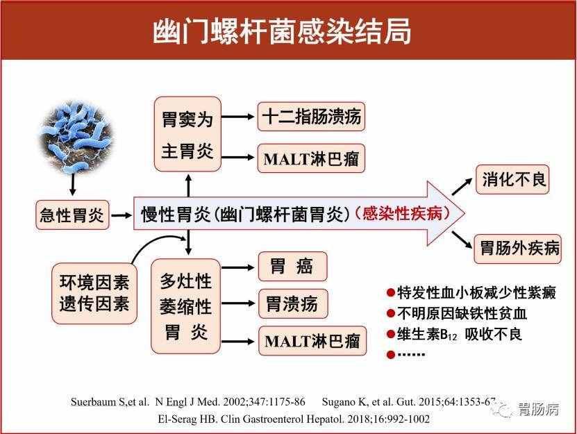 胃病都有哪些，什么症状