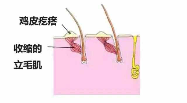 为何我们会起鸡皮疙瘩？听音乐起鸡皮疙瘩皆因天生异禀