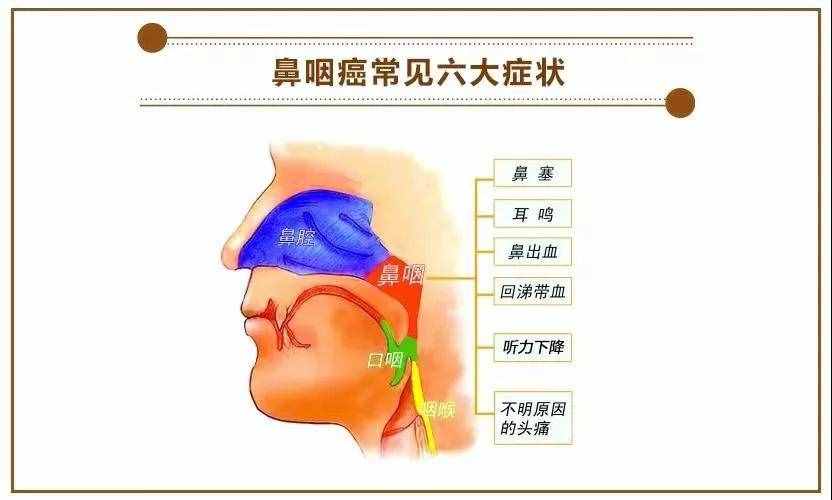 原来鼻塞都是由这些疾病引起的，有鼻塞症状的都应该了解一下。