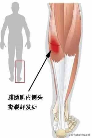 小腿疼痛的原因和治疗原则