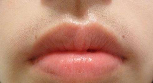 女性唇毛浓密惹人烦，这5个方法或许可以帮到你，不妨试试