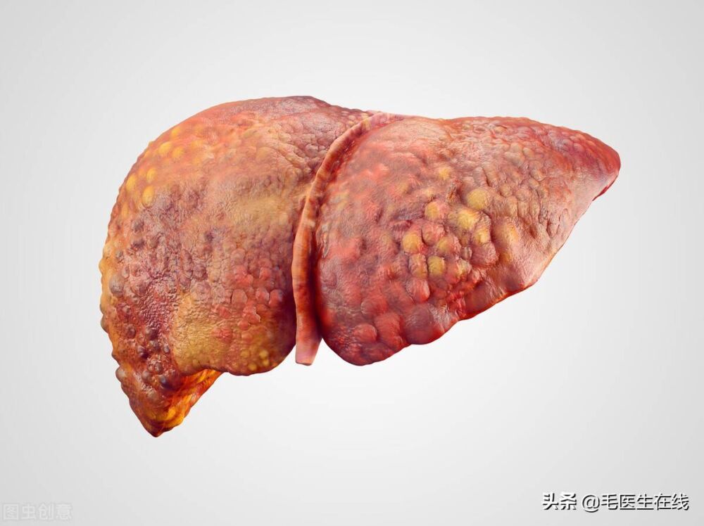 脂肪肝能治愈吗？不治疗会怎样？三个方法助你清除肝脏多余的脂肪