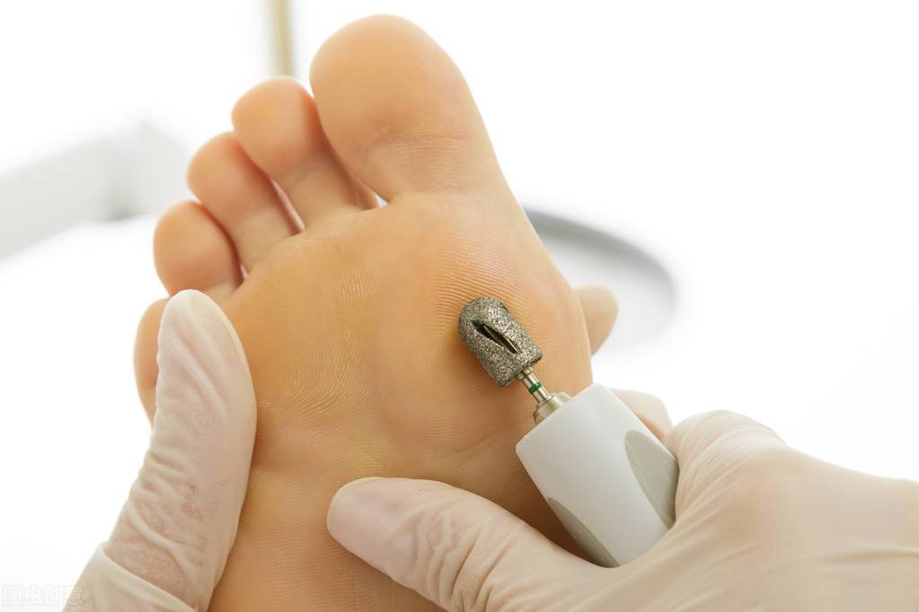 手脚干燥脱皮，与什么原因有关，吃什么能改善？营养学专家解答