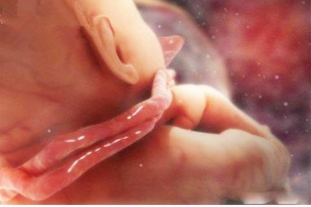 胎儿长期泡在羊水里，不会像大人一样被呛到吗？又是如何呼吸的？