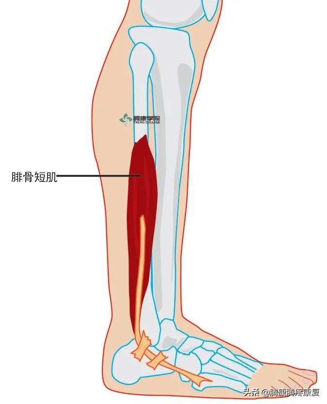 足外翻受限关键肌——腓骨肌