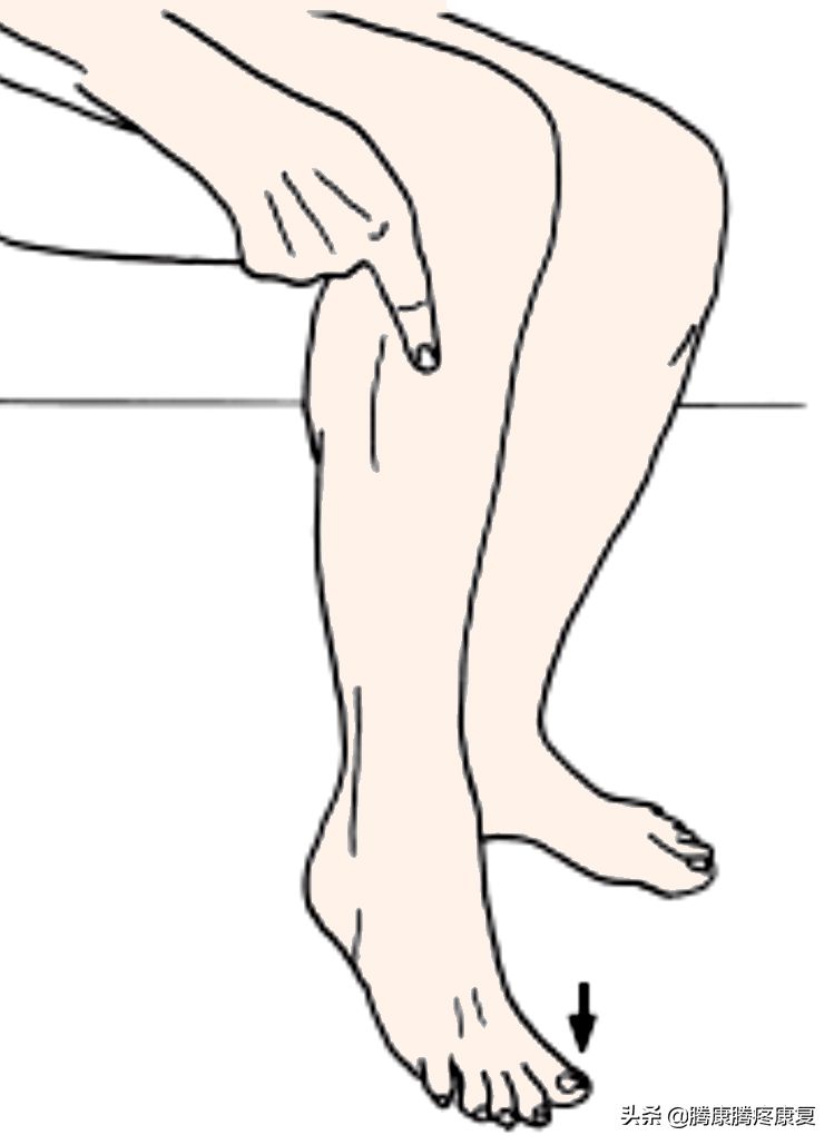 足外翻受限关键肌——腓骨肌