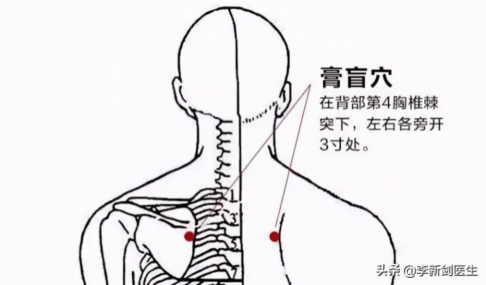 四大强壮要穴艾灸养生