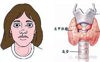 吃得多反消瘦：甲亢早期症状要知道！