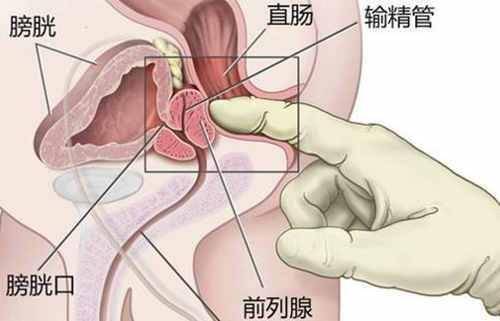 男性前列腺的构造及保养技巧