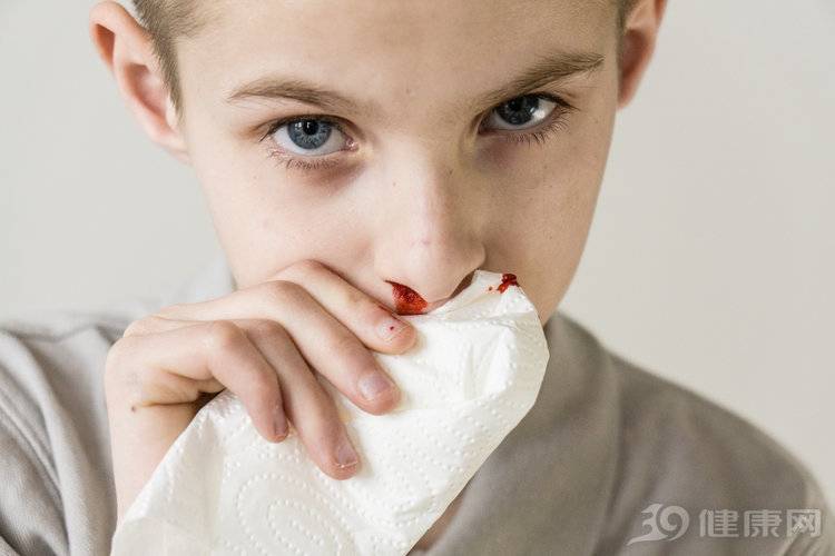 鼻出血是怎么回事？可能与这3个因素有关，不可小看