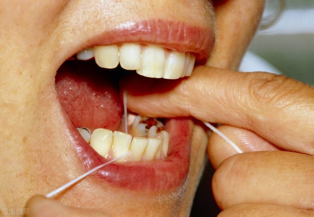 嘴巴有5个表现，或是牙齿在求救，可能有牙结石，看你是否中招？