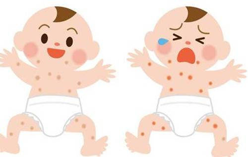 婴儿湿疹是由什么原因引起的？又应该如何防治呢？