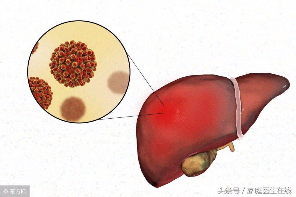 长期食欲不振，可能与这个疾病有关，最好去医院检查一下