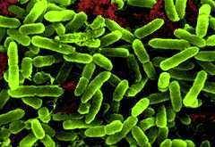 我咳的痰是黄绿色的，这是为什么？绿脓杆菌是什么菌？如何治？