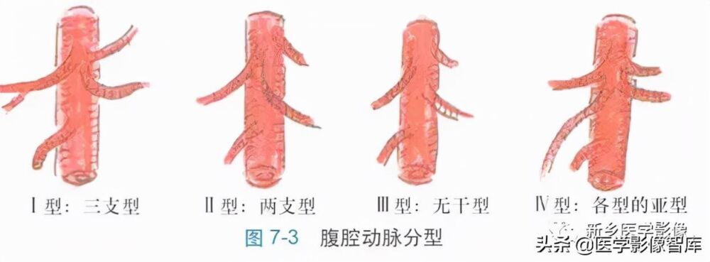 腹部主要血管正常解剖和变异