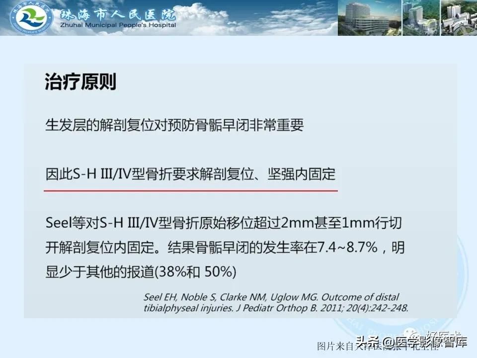 独立值班必备：66张胫骨骨折图解，不怕主任提问了