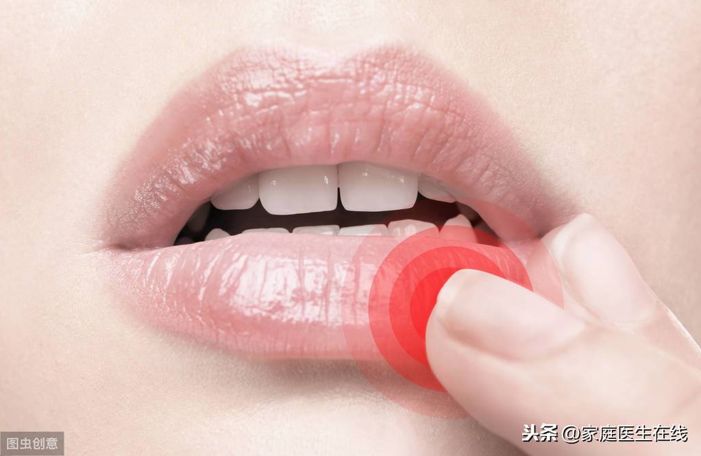 嘴角起泡是什么原因？可能是这几种疾病引起的