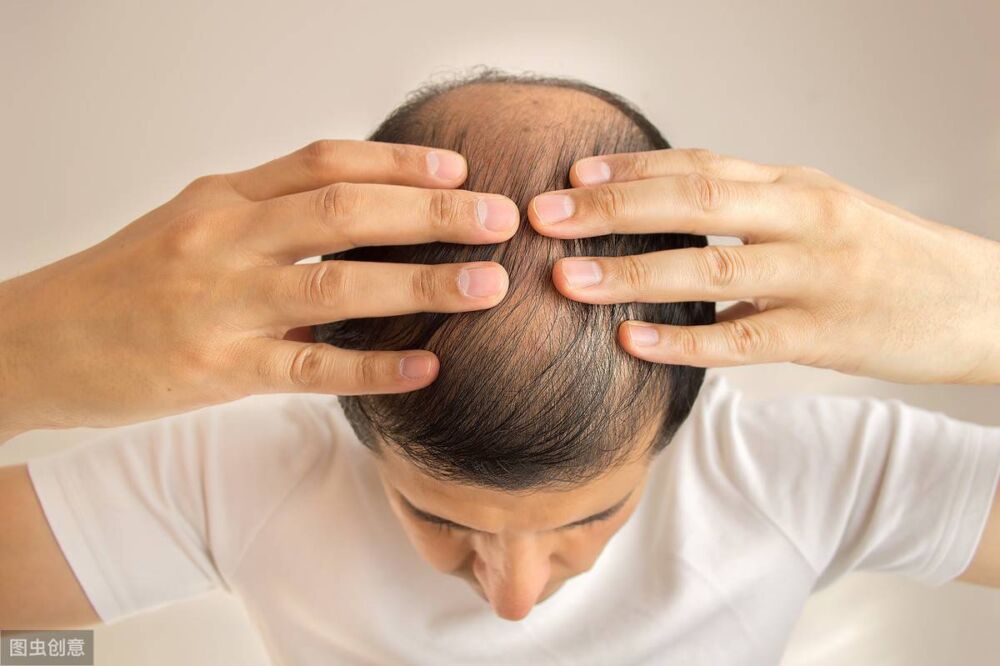 头发每天洗还是痒是怎么回事？中青年男女缓解头皮痒有哪些好方法