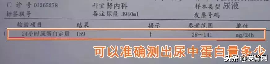 复查心里没底？简单易懂的肾内科检查解读，给每一位需要的肾友